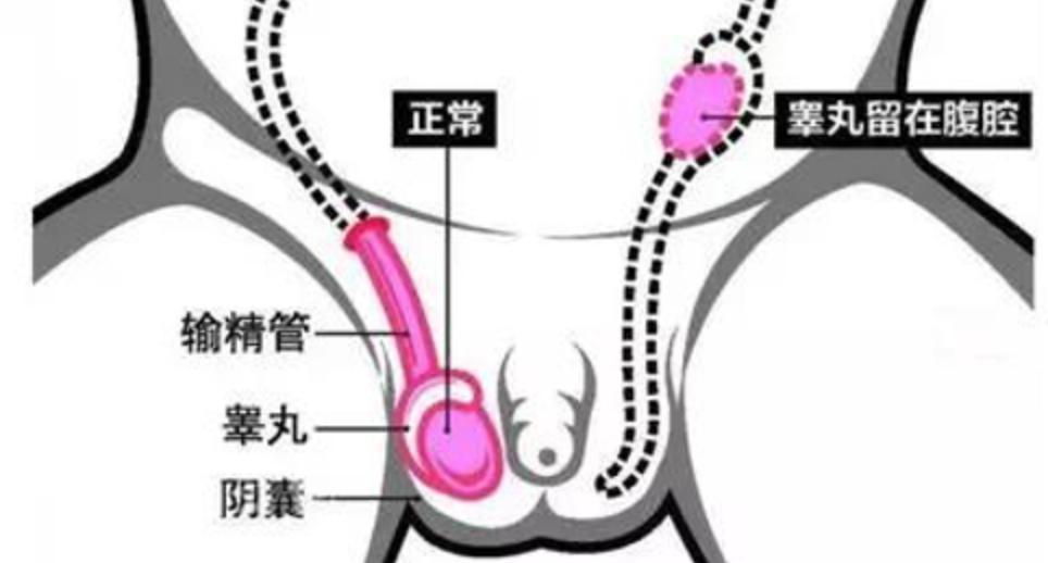 生殖器最新,生殖领域最新突破。