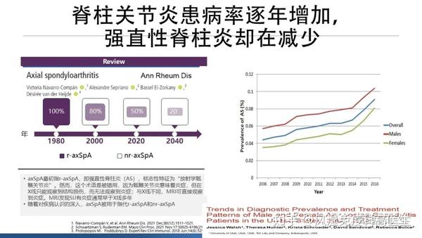 强直最新进展,直击强直性脊柱炎最新治疗突破