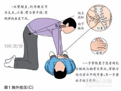 2015心肺复苏最新指南,2015版心肺复苏操作手册